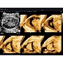 Accuvix V20 Prestige Oblique View ultrahang kép