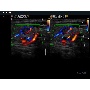 MySono U6 Color Doppler DEMO kép1
